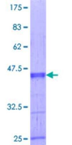 Novus Biologicals Recombinant Human ZNF239 GST (N-Term) Protein 10 &mu;g | Buy Online | Novus Biologicals&trade; | Fisher Scientific