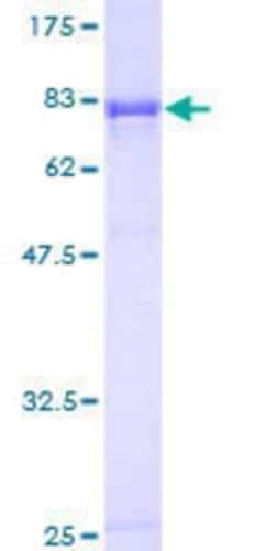 Novus Biologicals Recombinant Human Symplekin GST (N-Term) Protein 10 &mu;g | Buy Online | Novus Biologicals&trade; | Fisher Scientific