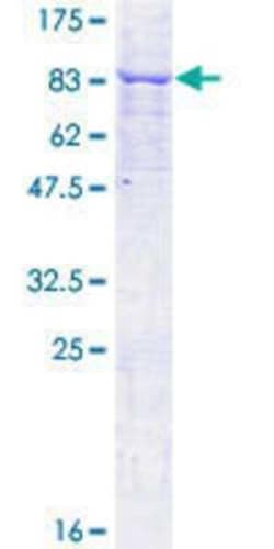 Novus Biologicals Recombinant Human MKKS GST (N-Term) Protein 10 &mu;g | Buy Online | Novus Biologicals&trade; | Fisher Scientific