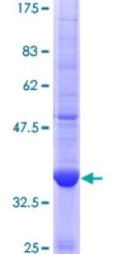 Novus Biologicals Recombinant Human MKKS GST (N-Term) Protein 2 &mu;g | Buy Online | Novus Biologicals&trade; | Fisher Scientific