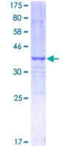 Novus Biologicals Recombinant Human NCOA3/AIB1 GST (N-Term) Protein 10 &mu;g | Buy Online | Novus Biologicals&trade; | Fisher Scientific