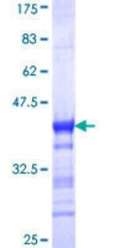 Novus Biologicals&trade;&nbsp;Recombinant Human RIP140 GST (N-Term) Protein