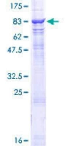 Novus Biologicals Recombinant Human CHAF1B GST (N-Term) Protein 25 &mu;g | Buy Online | Novus Biologicals&trade; | Fisher Scientific