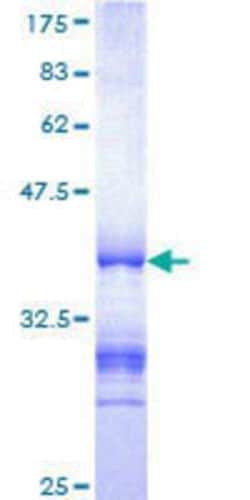 Novus Biologicals Recombinant Human DGCR14 GST (N-Term) Protein 25 &mu;g | Buy Online | Novus Biologicals&trade; | Fisher Scientific