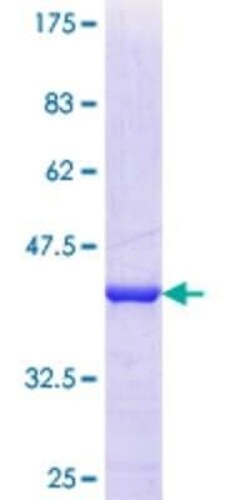 Novus Biologicals Recombinant Human GTPBP6 GST (N-Term) Protein 10 &mu;g | Buy Online | Novus Biologicals&trade; | Fisher Scientific