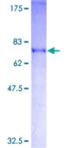 Novus Biologicals Recombinant Human XE7 GST (N-Term) Protein 2 &mu;g | Buy Online | Novus Biologicals&trade; | Fisher Scientific