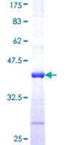 Novus Biologicals Recombinant Human XE7 GST (N-Term) Protein 25 &mu;g | Buy Online | Novus Biologicals&trade; | Fisher Scientific