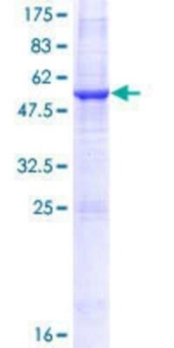 Novus Biologicals Recombinant Human PNPLA4 GST (N-Term) Protein 25 &mu;g | Buy Online | Novus Biologicals&trade; | Fisher Scientific