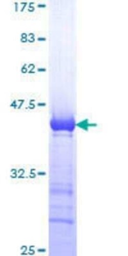 Novus Biologicals Recombinant Human SMC1 GST (N-Term) Protein 25 &mu;g | Buy Online | Novus Biologicals&trade; | Fisher Scientific