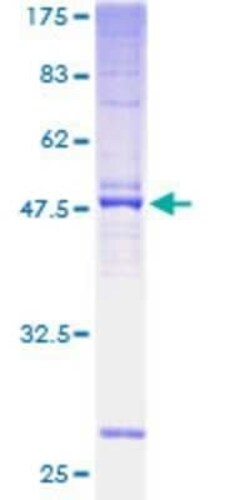 Novus Biologicals Recombinant Human TMEM187 GST (N-Term) Protein 25 &mu;g | Buy Online | Novus Biologicals&trade; | Fisher Scientific