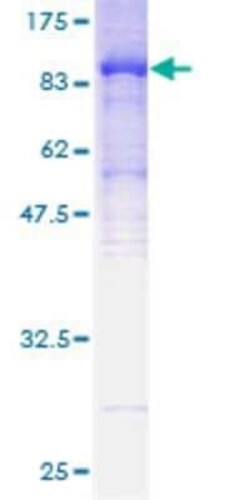 Novus Biologicals Recombinant Human TKTL1 GST (N-Term) Protein 25 &mu;g | Buy Online | Novus Biologicals&trade; | Fisher Scientific
