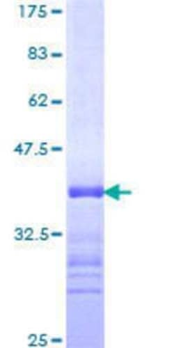 Novus Biologicals Recombinant Human ARID1A GST (N-Term) Protein 10 &mu;g | Buy Online | Novus Biologicals&trade; | Fisher Scientific