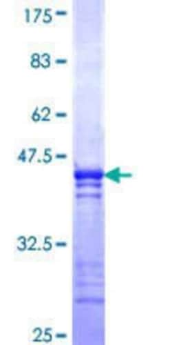 Novus Biologicals&trade;&nbsp;Recombinant Human COLQ GST (N-Term) Protein