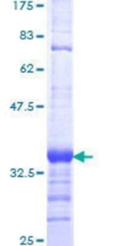 Novus Biologicals Recombinant Human SERF1A GST (N-Term) Protein 10 &mu;g | Buy Online | Novus Biologicals&trade; | Fisher Scientific