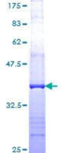 Novus Biologicals Recombinant Human TRRAP GST (N-Term) Protein 25 &mu;g | Buy Online | Novus Biologicals&trade; | Fisher Scientific