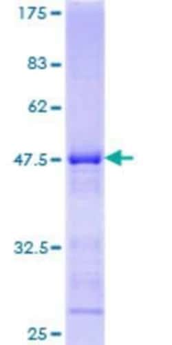 Novus Biologicals Recombinant Human KLRC4 GST (N-Term) Protein 10 &mu;g | Buy Online | Novus Biologicals&trade; | Fisher Scientific