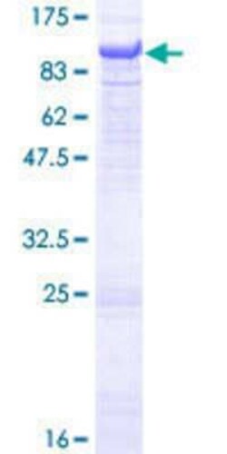 Novus Biologicals Recombinant Human ACOX2 GST (N-Term) Protein 10 &mu;g | Buy Online | Novus Biologicals&trade; | Fisher Scientific