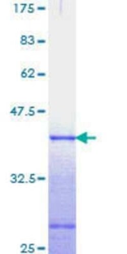 Novus Biologicals Recombinant Human Axin-2 GST (N-Term) Protein 25 &mu;g | Buy Online | Novus Biologicals&trade; | Fisher Scientific