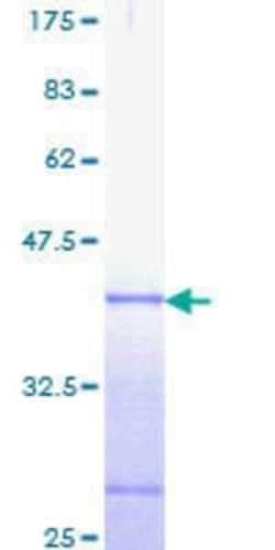 Novus Biologicals Recombinant Human Axin-2 GST (N-Term) Protein 10 &mu;g | Buy Online | Novus Biologicals&trade; | Fisher Scientific