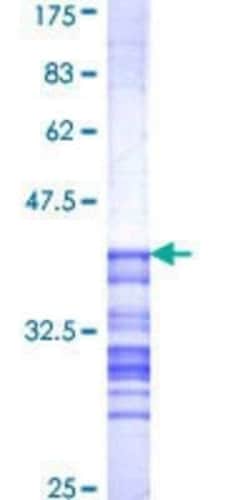 Novus Biologicals Recombinant Human CDC7 GST (N-Term) Protein 25 &mu;g | Buy Online | Novus Biologicals&trade; | Fisher Scientific