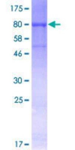 Novus Biologicals Recombinant Human CDC45L GST (N-Term) Protein 10 &mu;g | Buy Online | Novus Biologicals&trade; | Fisher Scientific