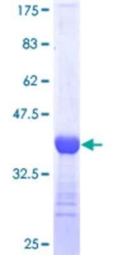 Novus Biologicals Recombinant Human EOMES GST (N-Term) Protein 10 &mu;g | Buy Online | Novus Biologicals&trade; | Fisher Scientific