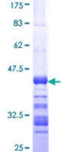 Novus Biologicals Recombinant Human GFI1B GST (N-Term) Protein 10 &mu;g | Buy Online | Novus Biologicals&trade; | Fisher Scientific