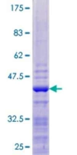 Novus Biologicals Recombinant Human HIST1H2AK GST (N-Term) Protein 10 &mu;g | Buy Online | Novus Biologicals&trade; | Fisher Scientific