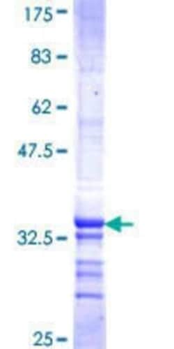Novus Biologicals Recombinant Human HIST1H2AK GST (N-Term) Protein 25 &mu;g | Buy Online | Novus Biologicals&trade; | Fisher Scientific