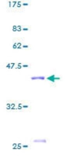 Novus Biologicals Recombinant Human HIST1H2AM GST (N-Term) Protein 25 &mu;g | Buy Online | Novus Biologicals&trade; | Fisher Scientific