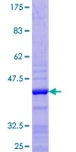 Novus Biologicals Recombinant Human Histone H2a GST (N-Term) Protein 25 &mu;g | Buy Online | Novus Biologicals&trade; | Fisher Scientific