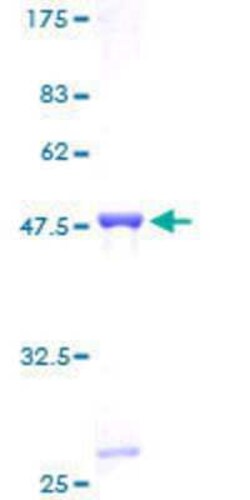 Novus Biologicals Recombinant Human HIST1H2BN GST (N-Term) Protein 10 &mu;g | Buy Online | Novus Biologicals&trade; | Fisher Scientific