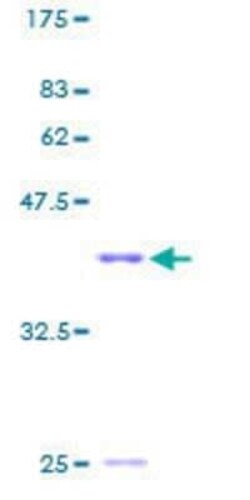 Novus Biologicals Recombinant Human HIST1H2BC GST (N-Term) Protein 10 &mu;g | Buy Online | Novus Biologicals&trade; | Fisher Scientific