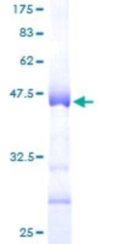 Novus Biologicals Recombinant Human HIST1H3D GST (N-Term) Protein 2 &mu;g | Buy Online | Novus Biologicals&trade; | Fisher Scientific