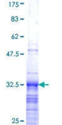 Novus Biologicals Recombinant Human HIST1H3G GST (N-Term) Protein 25 &mu;g | Buy Online | Novus Biologicals&trade; | Fisher Scientific