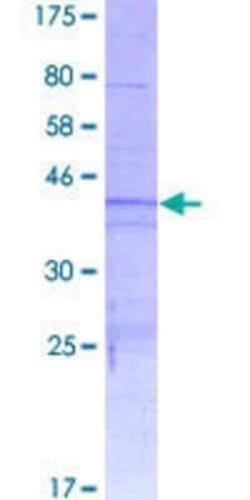 Novus Biologicals Recombinant Human H4/e GST (N-Term) Protein 2 &mu;g | Buy Online | Novus Biologicals&trade; | Fisher Scientific
