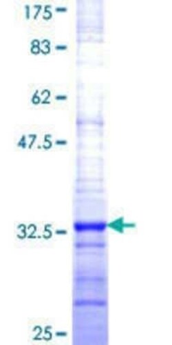 Novus Biologicals Recombinant Human H4/h GST (N-Term) Protein 2 &mu;g | Buy Online | Novus Biologicals&trade; | Fisher Scientific