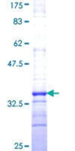 Novus Biologicals Recombinant Human H4/n GST (N-Term) Protein 10 &mu;g | Buy Online | Novus Biologicals&trade; | Fisher Scientific