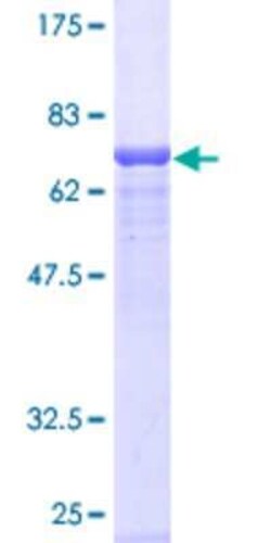 Novus Biologicals Recombinant Human HYAL3 GST (N-Term) Protein 2 &mu;g | Buy Online | Novus Biologicals&trade; | Fisher Scientific
