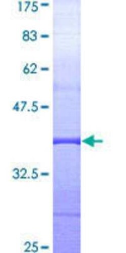 Novus Biologicals Recombinant Human MAD1L1/MAD1 GST (N-Term) Protein 25 &mu;g | Buy Online | Novus Biologicals&trade; | Fisher Scientific