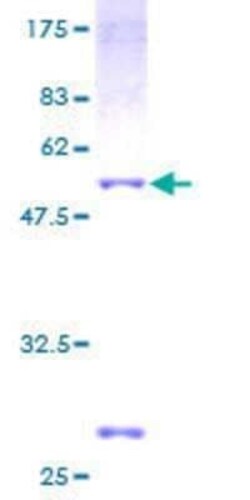 Novus Biologicals Recombinant Human NME5 GST (N-Term) Protein 2 &mu;g | Buy Online | Novus Biologicals&trade; | Fisher Scientific