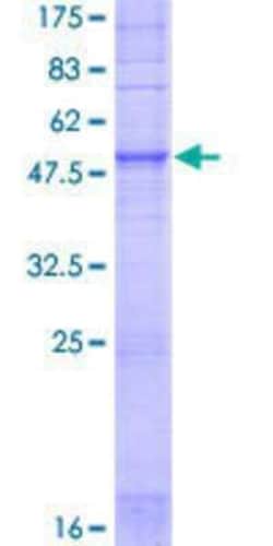 Novus Biologicals Recombinant Human OR1E1 GST (N-Term) Protein 25 &mu;g | Buy Online | Novus Biologicals&trade; | Fisher Scientific
