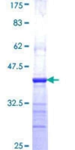 Novus Biologicals Recombinant Human PIP5K1 alpha GST (N-Term) Protein 10 &mu;g | Buy Online | Novus Biologicals&trade; | Fisher Scientific