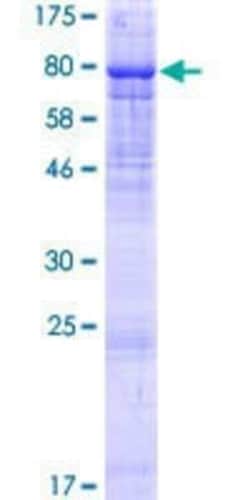 Novus Biologicals Recombinant Human MSS4 GST (N-Term) Protein 10 &mu;g | Buy Online | Novus Biologicals&trade; | Fisher Scientific