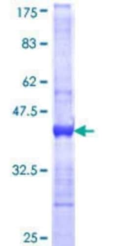 Novus Biologicals Recombinant Human MSS4 GST (N-Term) Protein 10 &mu;g | Buy Online | Novus Biologicals&trade; | Fisher Scientific