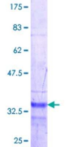 Novus Biologicals Recombinant Human Phospholipase A2 X GST (N-Term) Protein 25 &mu;g | Buy Online | Novus Biologicals&trade; | Fisher Scientific