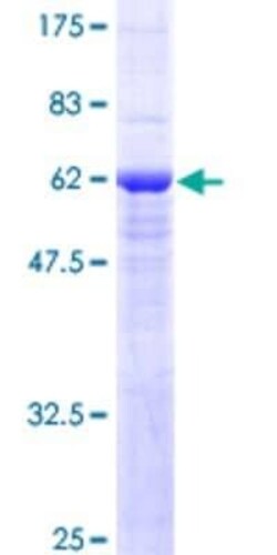 Novus Biologicals Recombinant Human SLC25A11 GST (N-Term) Protein 10 &mu;g | Buy Online | Novus Biologicals&trade; | Fisher Scientific