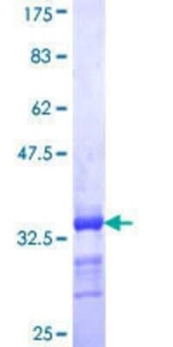 Novus Biologicals Recombinant Human EEA1 GST (N-Term) Protein 25 &mu;g | Buy Online | Novus Biologicals&trade; | Fisher Scientific