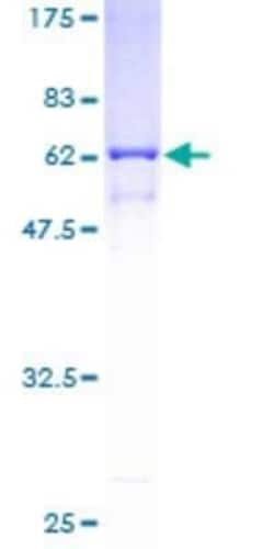Novus Biologicals Recombinant Human Annexin A9 GST (N-Term) Protein 10 &mu;g | Buy Online | Novus Biologicals&trade; | Fisher Scientific
