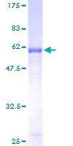 Novus Biologicals Recombinant Human Syntaxin 7 GST (N-Term) Protein 10 &mu;g | Buy Online | Novus Biologicals&trade; | Fisher Scientific